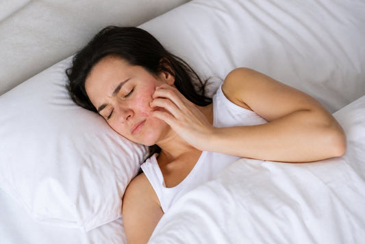 Do Hypoallergenic Sheets Stop Skin Rashes?